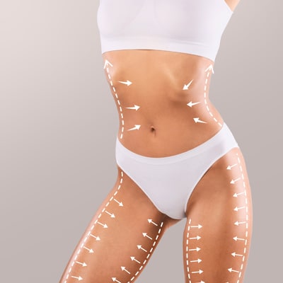 Ice Body Sculpting